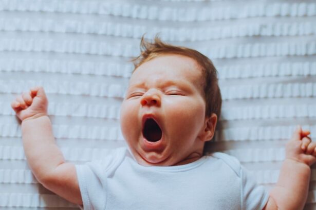 Bebeklerde Egzama Nasıl Geçer